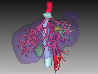 Case report: dual primary malignancies treated by laparoscopic multiorgan resection with natural orifice specimen extraction surgery